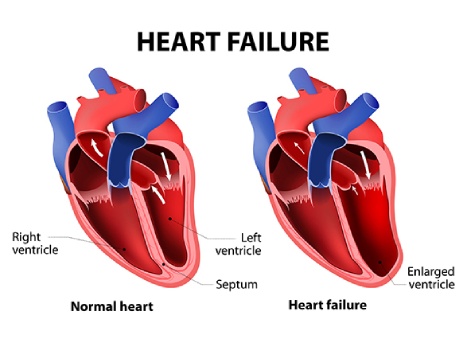 Medical – Magnets Used in A Heart Surgery